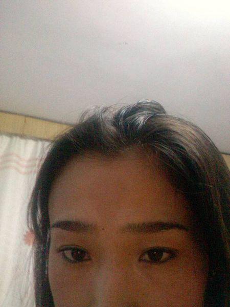 印堂发黑的真实图片,印堂发黑是什么征兆如何破解?本文共(963字) 印堂发黑的真实图片,印堂发黑是什么征兆如何破解?本文共(963字)