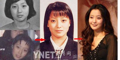 金喜善整容前,金喜善和全智贤(金喜善整过容吗?) 金喜善整容前,金喜善和全智贤(金喜善整过容吗?)